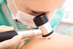 Analisi sospetto melanoma: è fondamentale la diagnosi precoce
